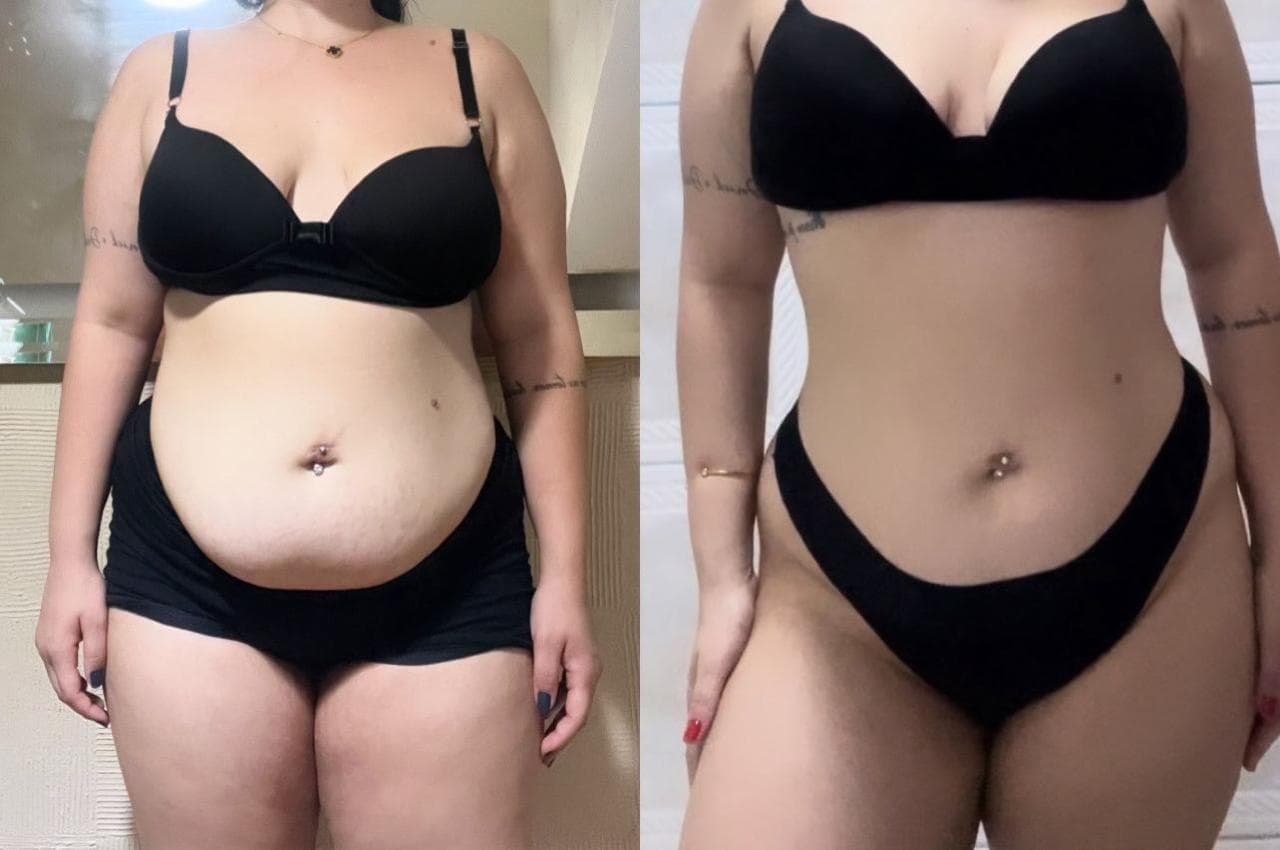 Antes e depois — emagrecimento e redefinição do abdômen